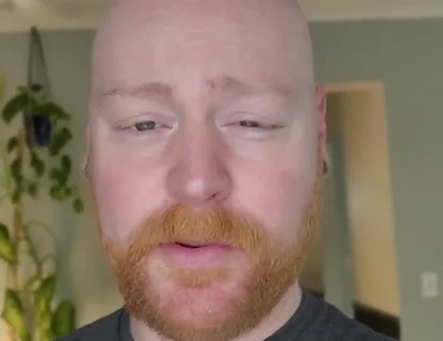 And as Always, It'll Grow Back