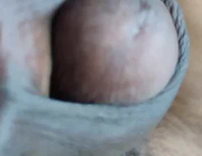My Penis