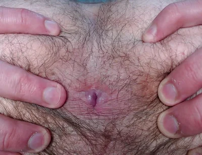 By Popular Demand, I Farted and Showed My Hairy Ass.