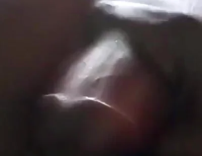 Sperm