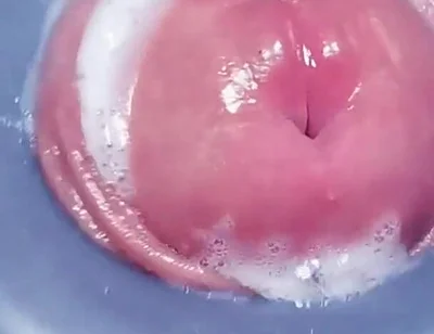 Penis Machine with a New Attachment