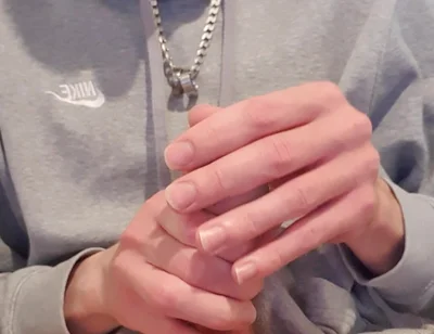 Skinny Lad Pulls Back Skin to Show Bellend