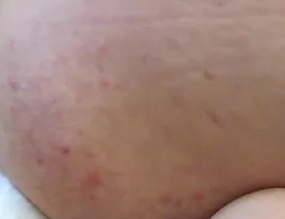 More Hotel Fun