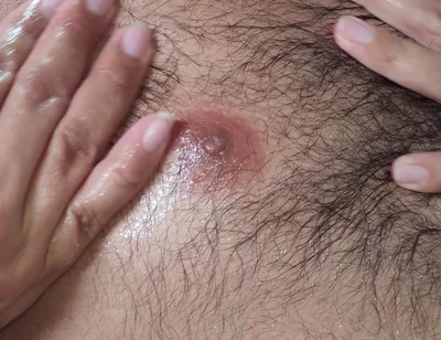 Oil on My Belly
