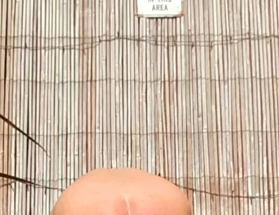 Anal Stretching