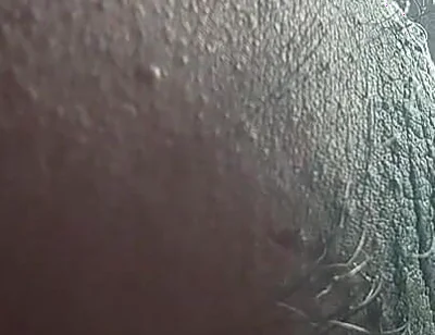 Armpit