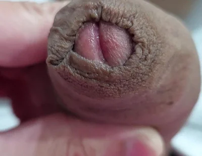 The Head of My Penis