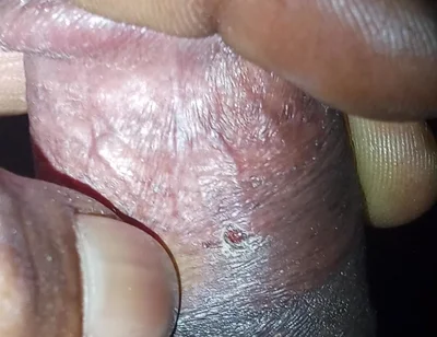 Now Videos