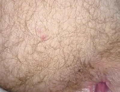 Eat My Ass and Drink My Nut