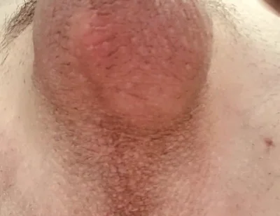 Do You Like Shaved or Hairy?
