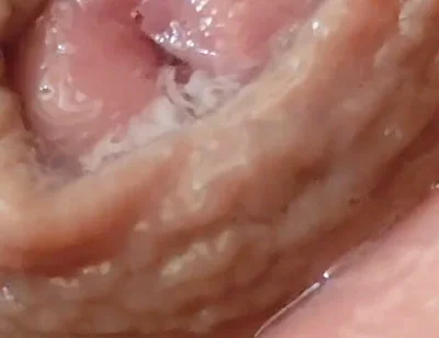 Juice From the Glans When Excited to the Extreme.