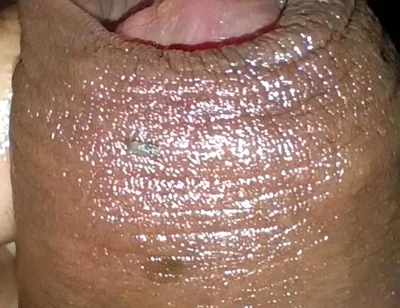 Close-up of Foreskin and Ejaculation in My Pants