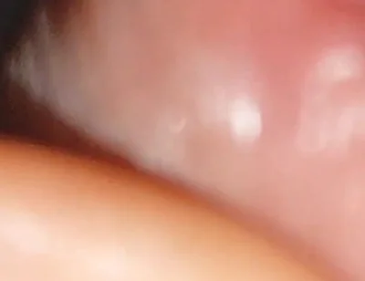 Hot Daddy in Close-up of the Inside of the Glans!