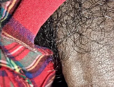 Close up on These Thick Veins
