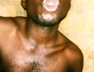 My Great Massaging and Maculation
