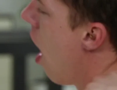 Exposed