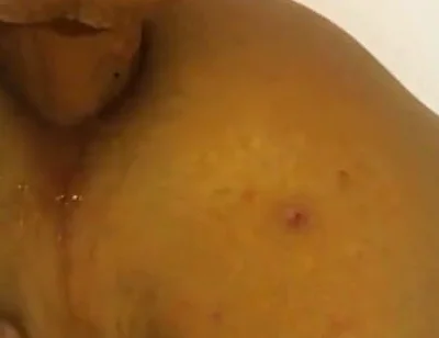 Deep in the Butt