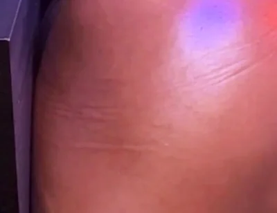 Bubble Butt
