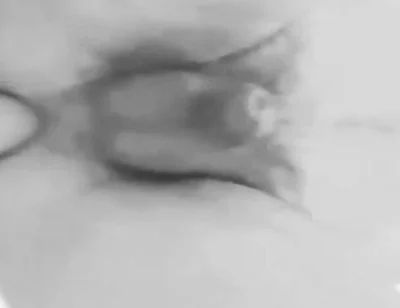 Anal Plaisure