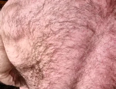Hairy Muscle Back