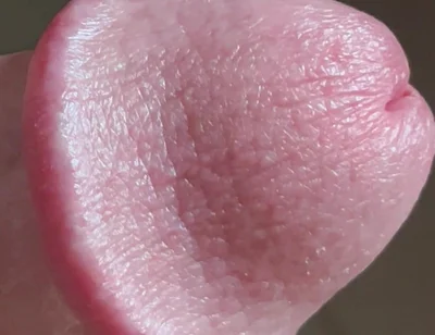 Closeup of Penis with One Vein