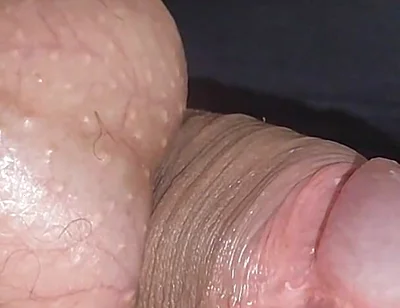 Amazing Upright Rough Venous Frenulum.