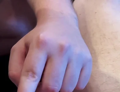 A Friend Plays with My Little Foreskin Cock