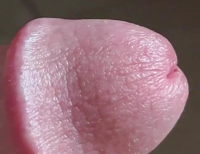 Closeup of Penis with One Vein