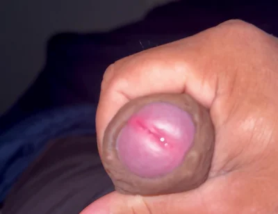 My Penis