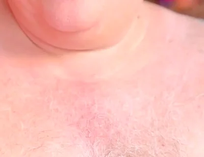 Old Man with Thickest Mushroom Penis