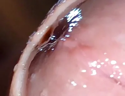 Glans Eye Watering After Intense Fucking.