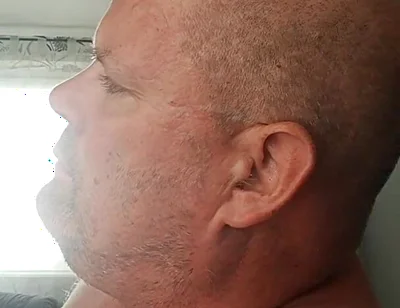 Renewed Destruction of the Bitch