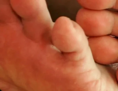 The Foot Master's Installation Protocol