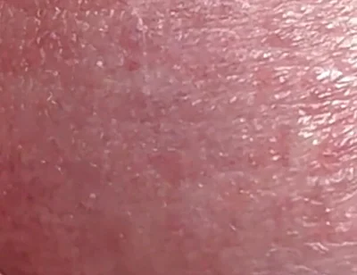 Sperm Close-up Front