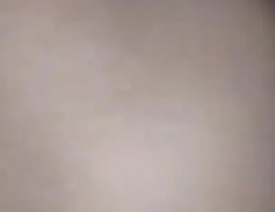 Destroying the Asshole on the Dick