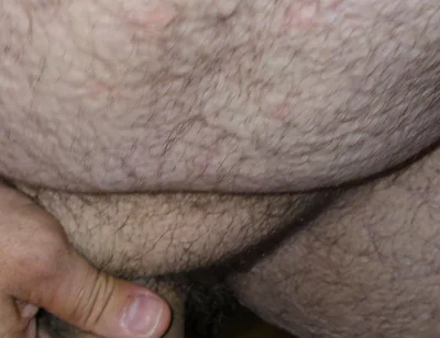 hairy
