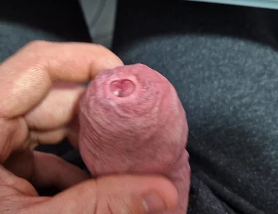 Uncut Tight Phimosis Cock Precum Tease for Foreskin Lovers with Cumshot