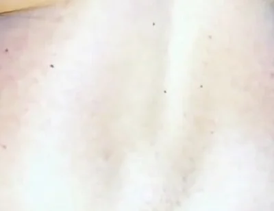 Extreme Anus Gape