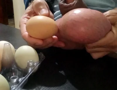 Measuring and Eggs Comparing