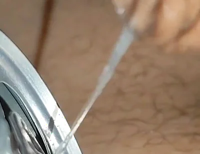 Immense Phimosis in the Can Makes You to the Extreme!