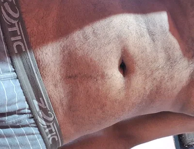 Masturbation