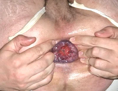 Young Sissy's Gaped Asshole Is Ready for Fisting