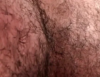 Hairy