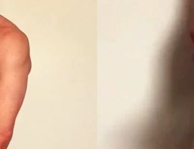Masturbation