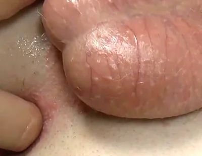 Stick Your Fingers in Casper's Butt
