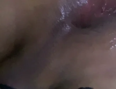 Surprise