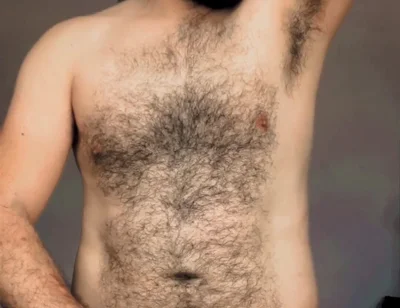 May Hairy Males Be Eternal