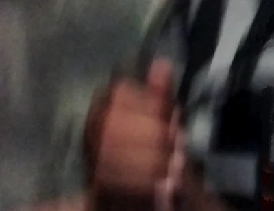 My Hand Exploded When Exposed to Masturbation
