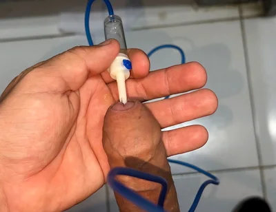 Sounding Extreme Sharp Probing in the Urethral Canal