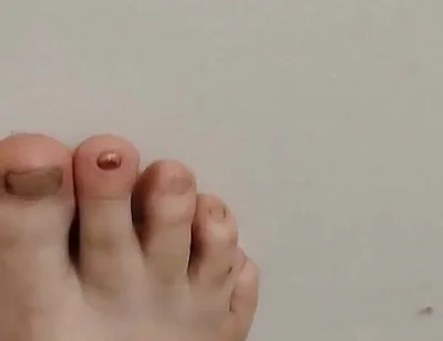 11-26-2025 Cute Little Toes